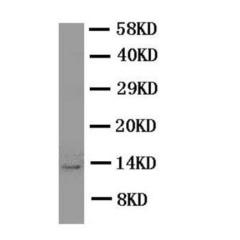 Anti-Estrogen Inducible Protein pS2/TFF1 Antibody