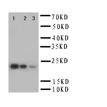 Anti-Interleukin-6 IL6 Antibody