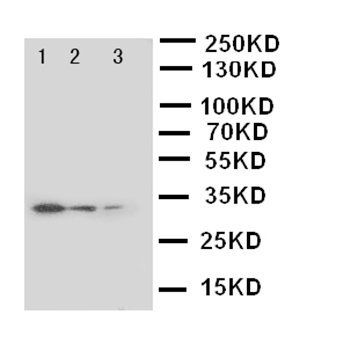 Anti-SOCS3 Antibody