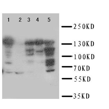 Anti-Replication factor C subunit 1 RFC1 Antibody