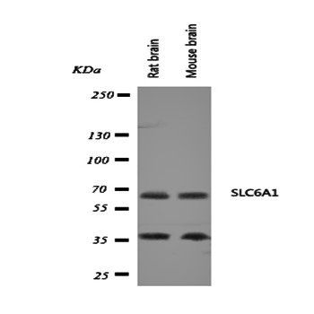 Anti-GABA Transporter 1/GAT 1/SLC6A1 Antibody