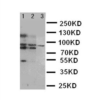 ABCB6 Antibody