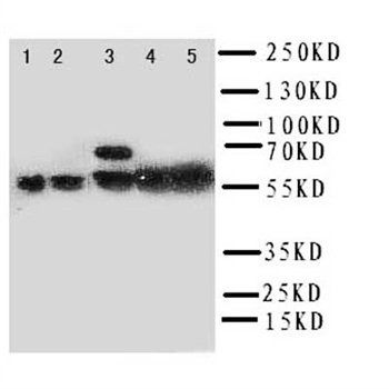 COX2/Cyclooxygenase 2/PTGS2 Antibody