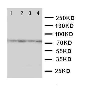 PAK6 Antibody