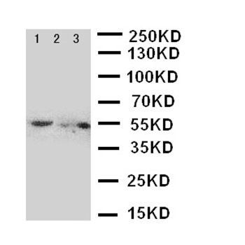 Glucose Transporter 5 GLUT5/SLC2A5 Antibody