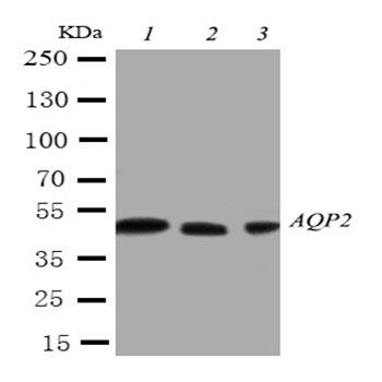Anti-Aquaporin 2/AQP2 Antibody