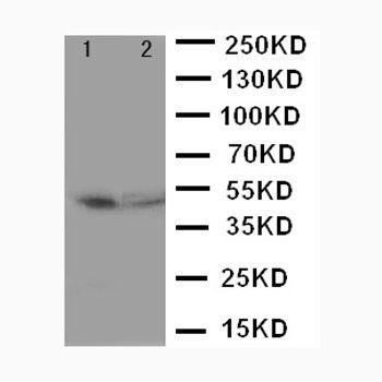 Anti-CD2/CD2 Antibody