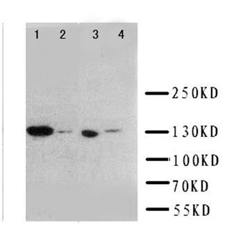 Anti-IGF1 Receptor/IGF1R Antibody