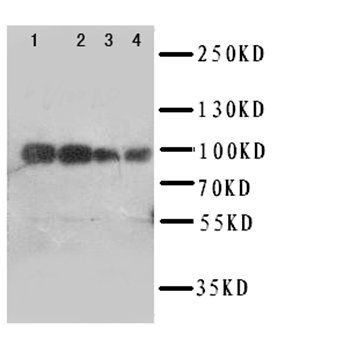 Anti-Myelin-associated glycoprotein MAG Antibody