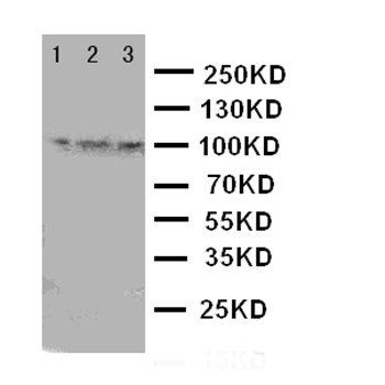 Anti-TRPC6 Antibody