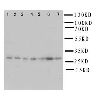 SIAH Interacting Protein/CACYBP Antibody