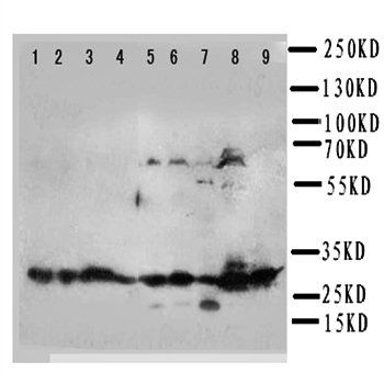 Western blot analysis of Lane 1: MCF-7 Cell Lysate, Lane 2: HELA Cell Lysate, Lane 3: MM231 Cell Lysate, Lane 4: M453 Cell Lysate, Lane 5: A549 Cell Lysate, Lane 6: SMMC Cell Lysate, Lane 7: COLO320 Cell Lysate, Lane 8: SW620 Cell Lysate, Lane 9: HT1080 C