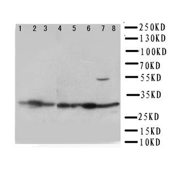 Anti-VDAC/Porin/VDAC1 Antibody