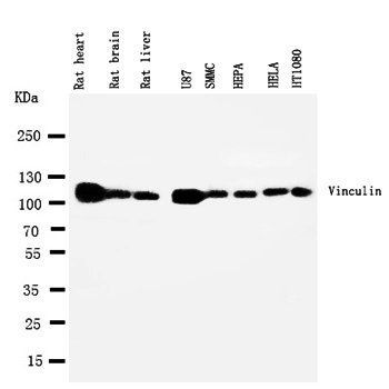 Anti-Vinculin/VCL Antibody