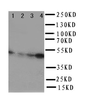 Anti-Aurora A/AURKA Antibody