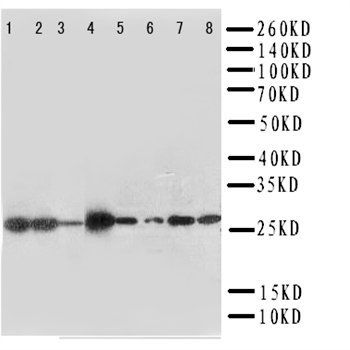 LIM and SH3 domain protein 1 LASP1 Antibody