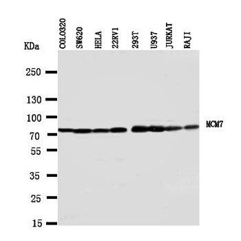 Anti-MCM7 Antibody