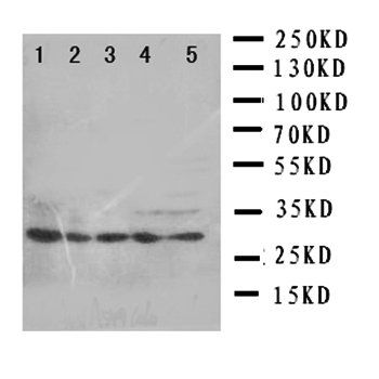 Anti-14-3-3 sigma/SFN Antibody