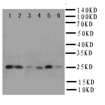 Anti-Heat shock protein beta-2 HSPB2 Antibody