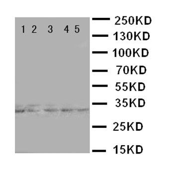 Transcription factor E2F6 E2F6 Antibody