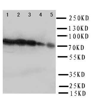 Hsp70/HSPA1A/HSPA1B Antibody