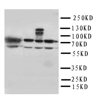 Anti-HSPA2 Antibody