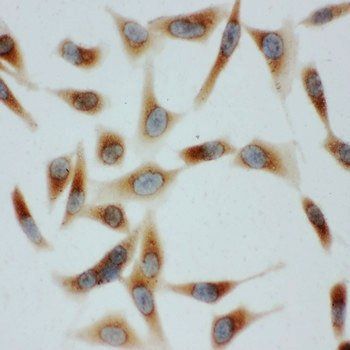 Anti-GRP78 BiP/HSPA5 Antibody