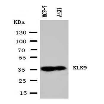 Kallikrein 9/KLK9 Antibody