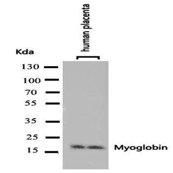 Myoglobin/MB Antibody