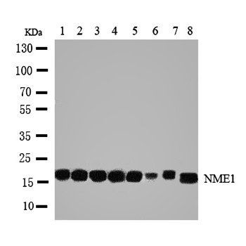 Anti-NM23A/NME1 Antibody