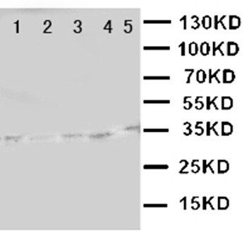 Anti-LOX 1/OLR1 Antibody