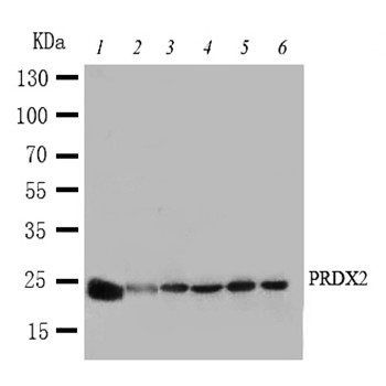 Anti-Peroxiredoxin 2/PRDX2 Antibody