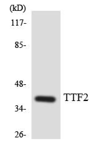 FoxE1 antibody