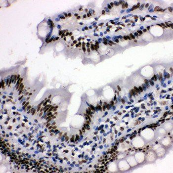 Anti-Histone deacetylase 3 HDAC3 Antibody