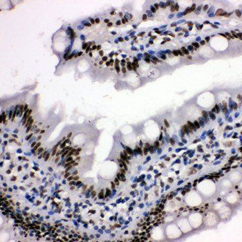 Histone deacetylase 3 HDAC3 Antibody