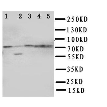Anti-ABCG1 Antibody