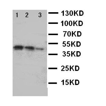 DDR2 Antibody