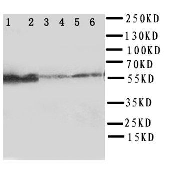 Flavin containing monooxygenase 4/FMO4 Antibody