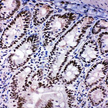 Anti-SHC/SHC1 Antibody