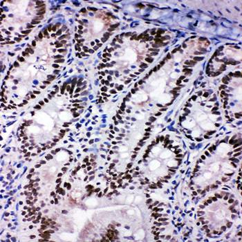 SHC/SHC1 Antibody