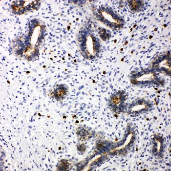 Anti-TRIF/TICAM1 Antibody
