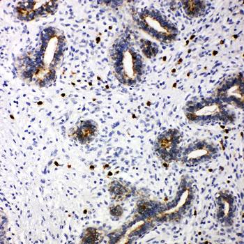 TRIF/TICAM1 Antibody