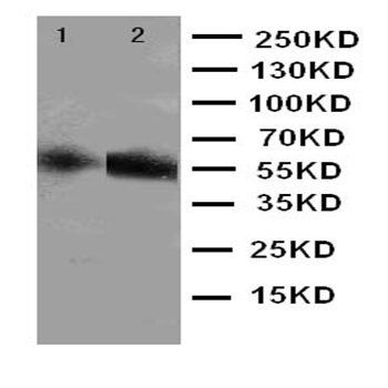 Cytochrome P450 2E1/CYP2E1 Antibody