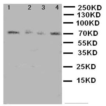 MEKK3/MAP3K3 Antibody