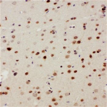 Anti-MEKK3/MAP3K3 Antibody