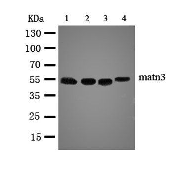 Matrilin 3/MATN3 Antibody