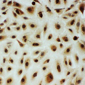 Anti-B MyB/MYBL2 Antibody