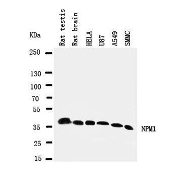 Nucleophosmin/NPM1 Antibody