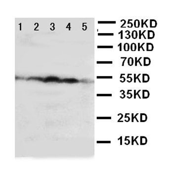 HSC70 Interacting Protein HIP/ST13 Antibody