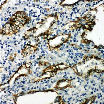 Anti-Aquaporin 4/AQP4 Antibody